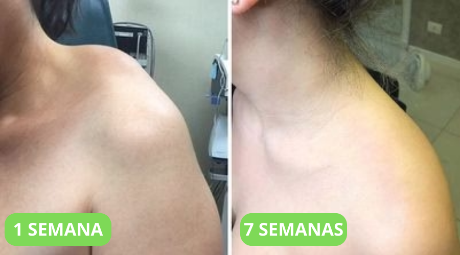 1 SEMANA